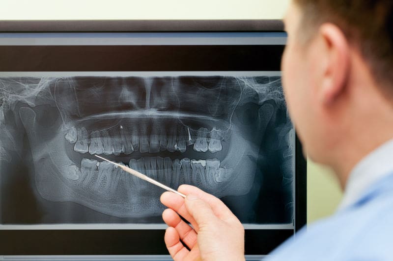 Emergency Dentist North Bethesda With dental x-ray