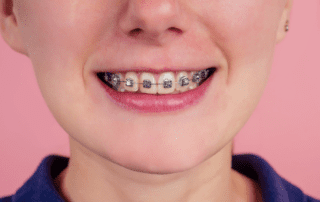 Teenager proudly displaying her braces.