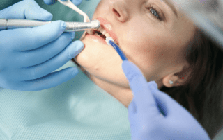 Female patient undergoing teeth whitening treatment.
