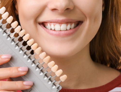 The Benefits of Dental Implants for Tooth Replacement