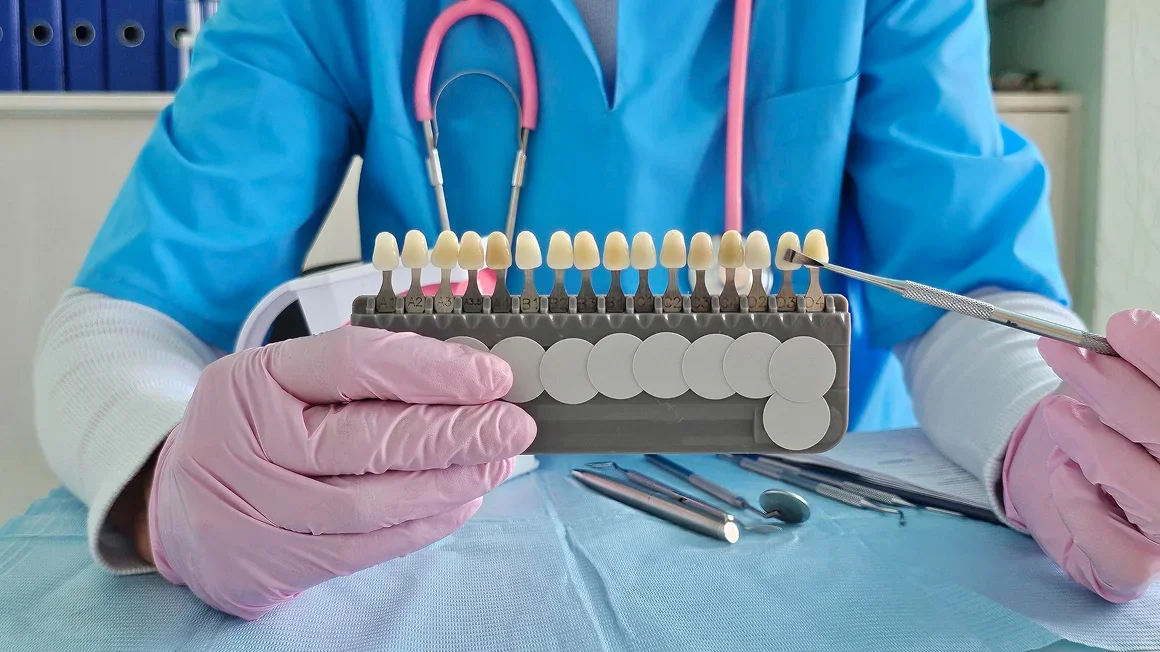 How Long Do Dental Veneers Take? A Realistic Timeline from Start to Finish